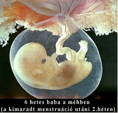 Abortusz